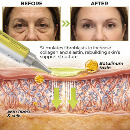 Lift & Smooth Anti-Wrinkle Cream - 50% Off Offer