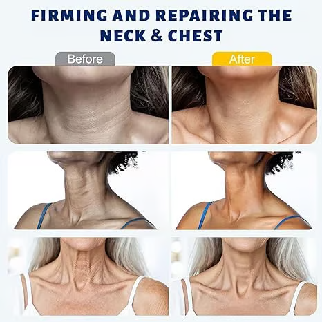 Roller Massage Neck Cream Collagen & Hyaluronic Acid | Firms Neck, Reduces Wrinkles & Double Chin