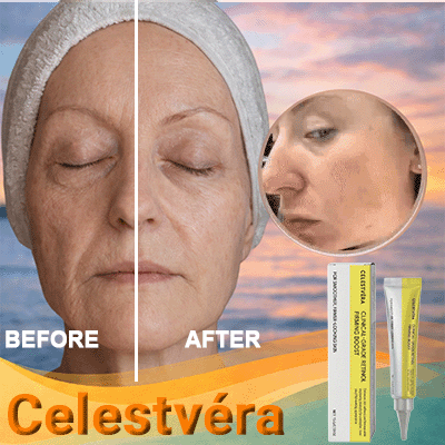 Anti-wrinkle cream product gallery
