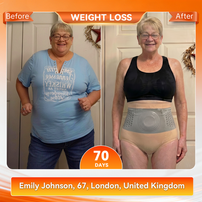 Moringa & Berberine 4‑In‑1 Micro‑Particle Sculpting & Fat‑Burn Shorts
