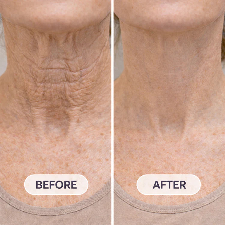 Roller Massage Neck Cream Collagen & Hyaluronic Acid | Firms Neck, Reduces Wrinkles & Double Chin