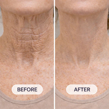 Roller Massage Neck Cream Collagen & Hyaluronic Acid | Firms Neck, Reduces Wrinkles & Double Chin