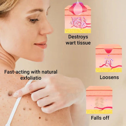 Microneedle Skin Tag Patch - 14-Day Clear Skin